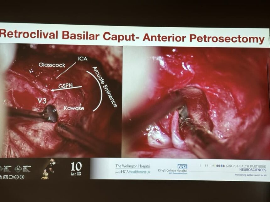 Skull base 🧠 tumor & aneurysm surgical training under 3D exoscopic vision