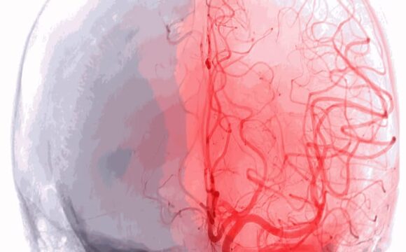 3rd Athens Cerebral vascular and endovascular (24-25 April 2026 Athens)