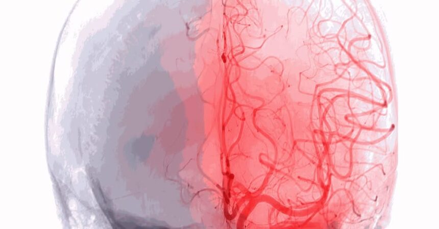 3rd Athens Cerebral vascular and endovascular (24-25 April 2026 Athens)